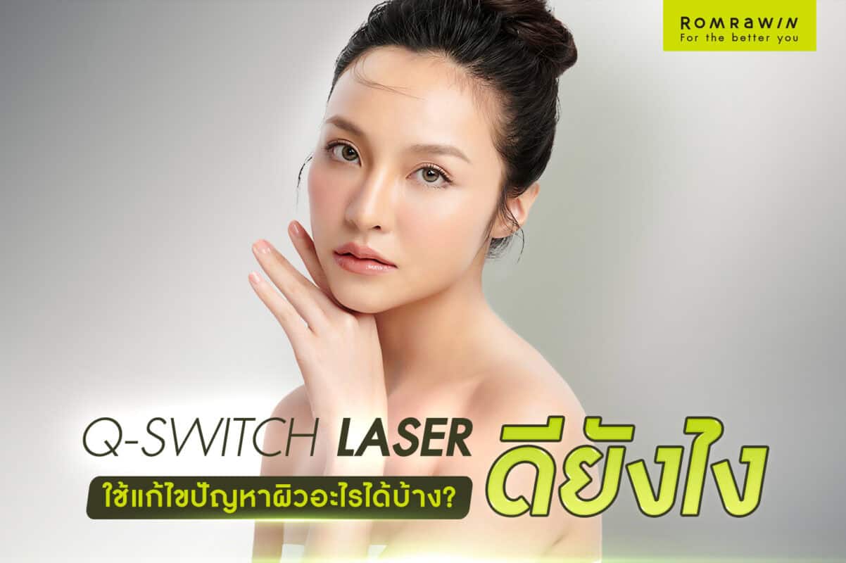 laser q switch nd yag