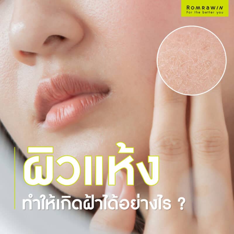 ผิวแห้งทำให้เกิดฝ้าได้อย่างไร