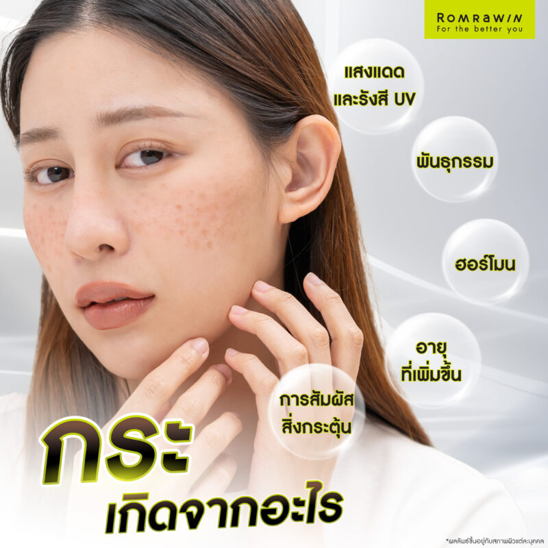 กระ เกิดจากอะไร ?