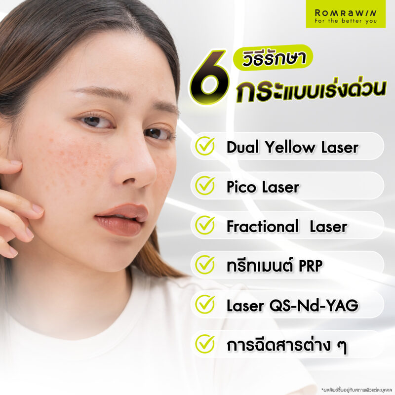 รวม 6 วิธีรักษากระแบบเร่งด่วน