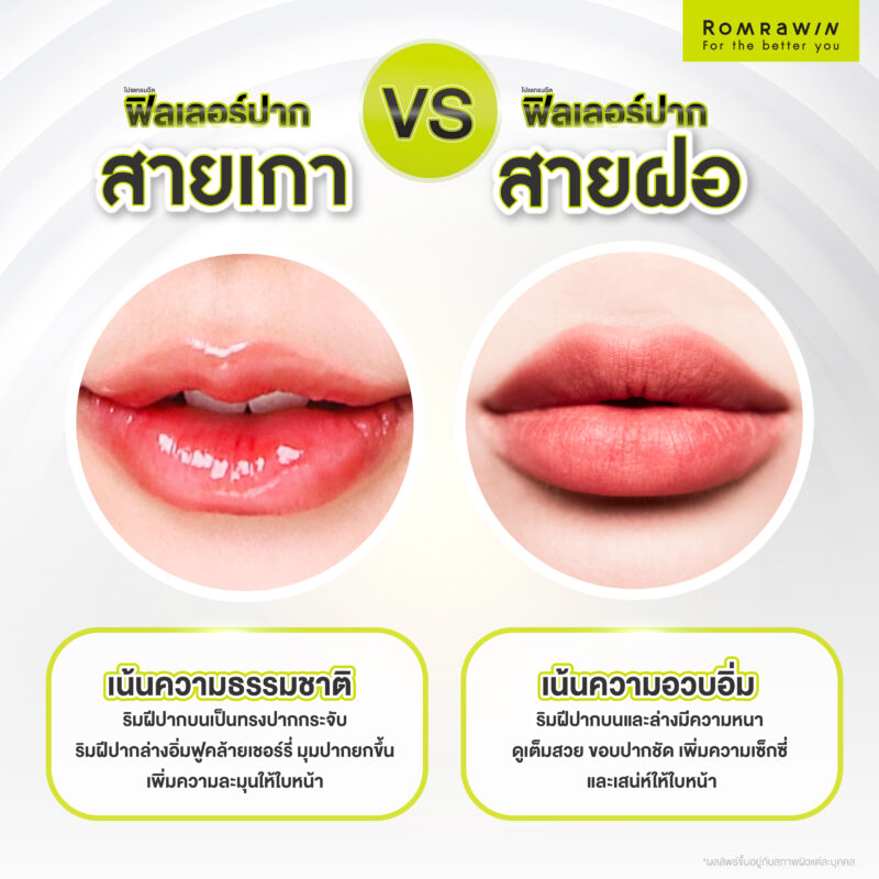 ฉีดฟิลเลอร์ปากสายเกา กับ สายฝอ ต่างกันอย่างไร